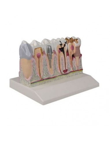 Modelo anatómico dentário, ampliado 4...