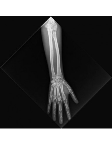 Simulador de radiologia - Antebraço...