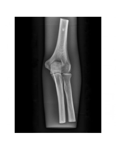 Simulador de radiologia - Cotovelo...
