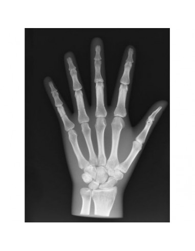Simulador de radiologia - Mão opaca...