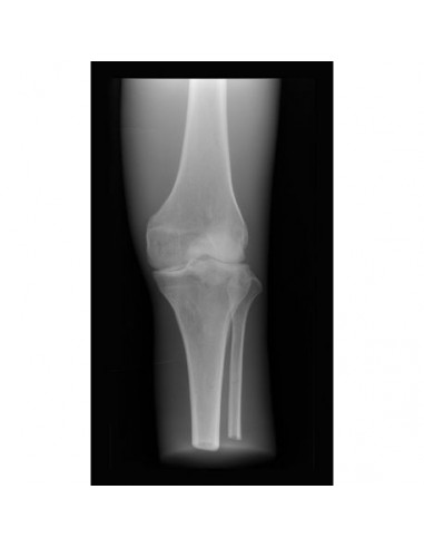Simulador de radiologia - Joelho...