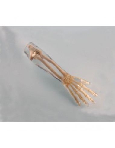 Simulador de radiologia - Braço...