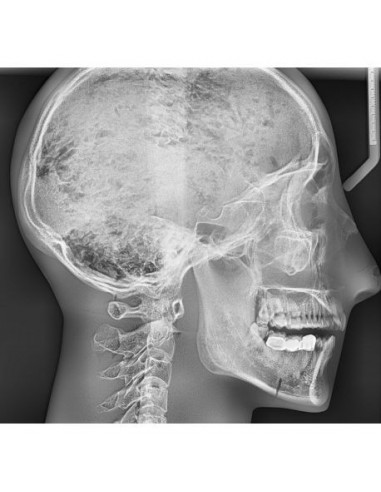 Simulador de radiologia - Crânio...