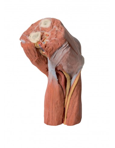 Fossa ulnar: músculos, nervos...