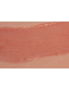 Moulage de ferida de úlcera... 2