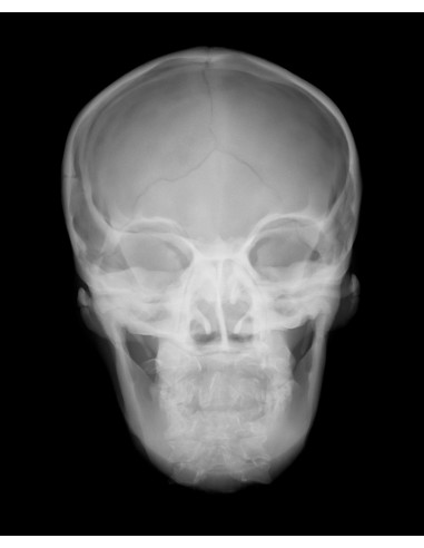 Simulador de radiologia - Crânio...