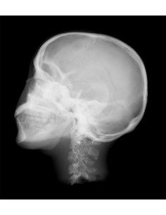 Simulador de radiologia -... 2