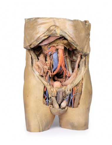 Dissecção abdominal com hérnias...