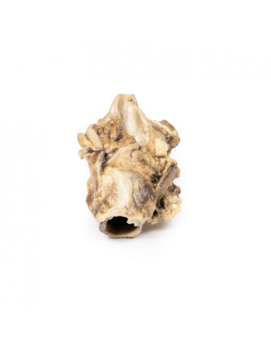 Carcinoma da fossa piriforme - Erler...