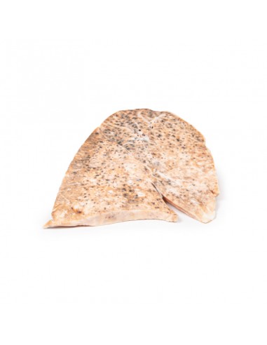 Tuberculose miliar do pulmão direito...