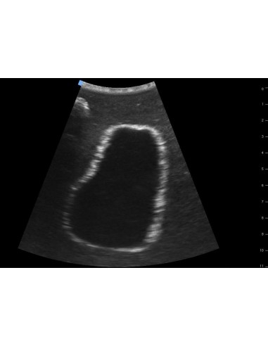 SONOEZ BLADDER ULTRASOUND TRAINER