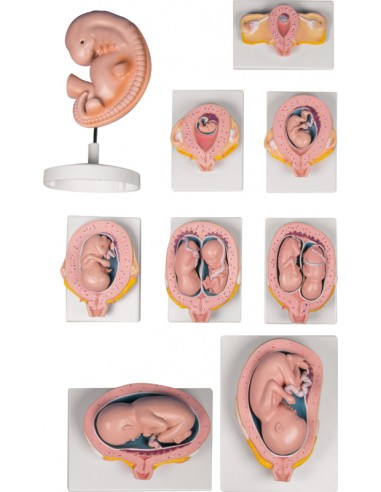 Conjunto completo de gravidez, 9...
