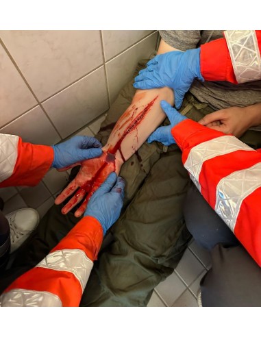 Moulage de tentativa de suicídio...