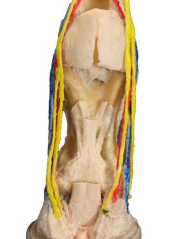 Dissecção palmar profunda da pata de...